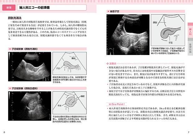 コンパクト超音波neo 産婦人科アトラス」〔新装改訂版〕2月下旬