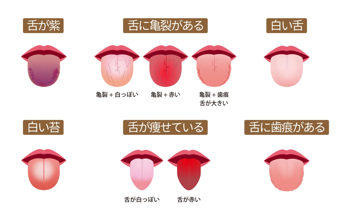 【歯科医が解説】舌は身体の健康を映す鏡?東洋医学の舌診と現代医学の視点|Shinichi Takeuchi