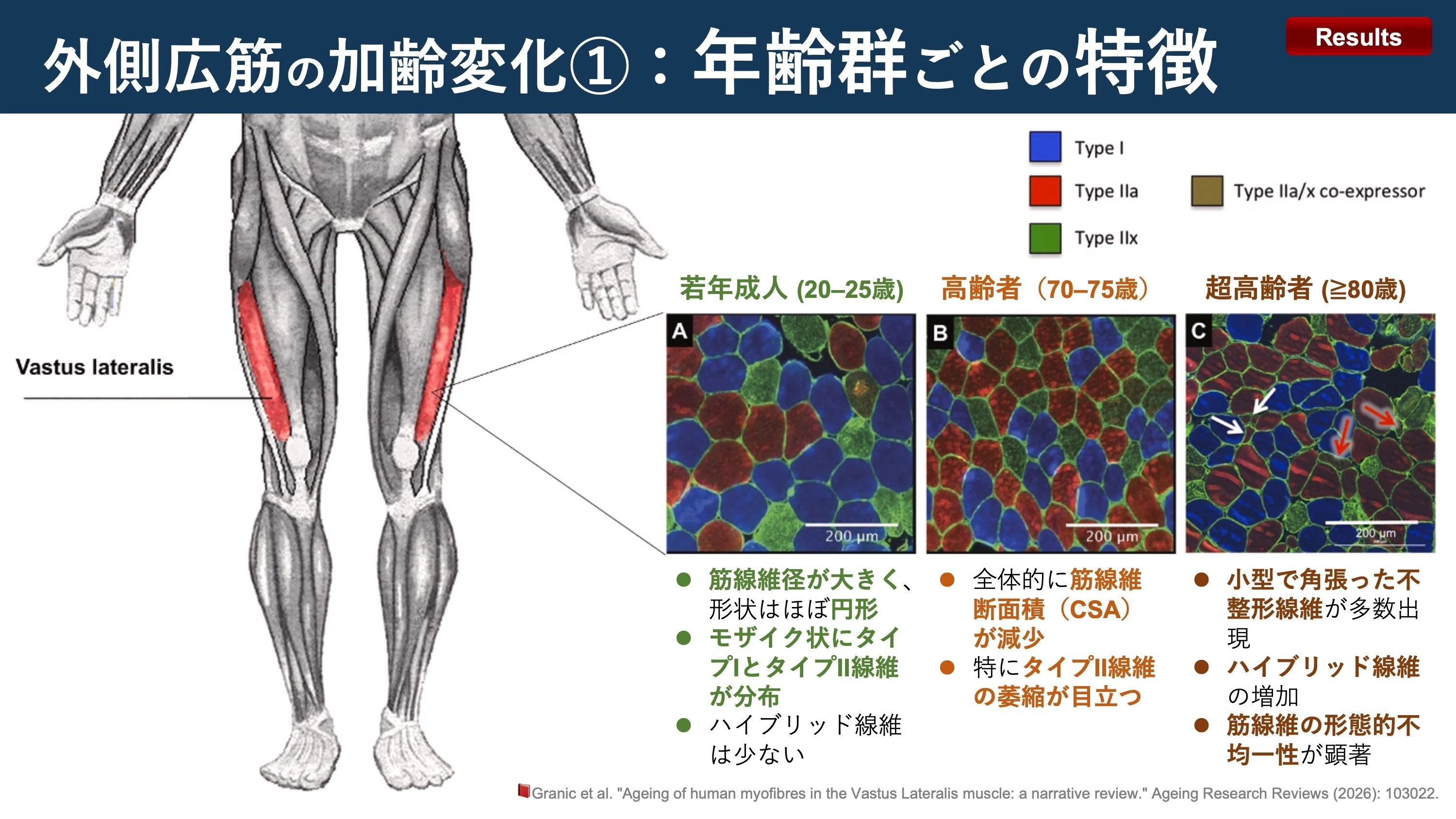 外側広筋の加齢変化｜Super Human | 理学療法士／保健学博士 Ph.D.