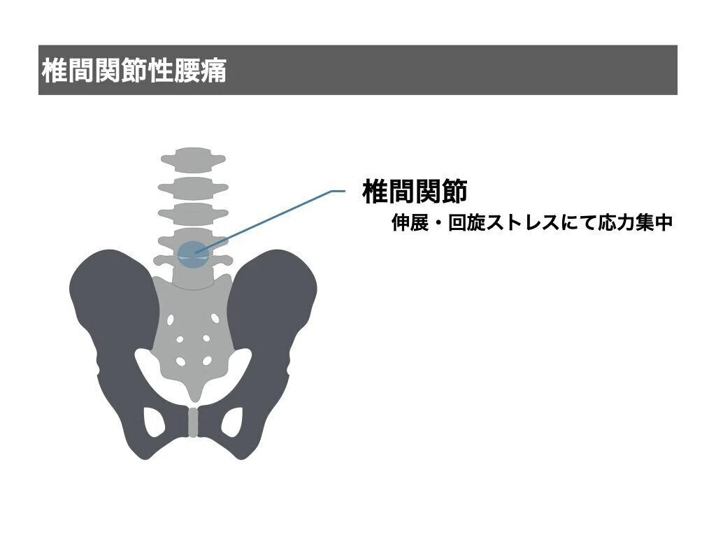 腰痛に対するアプローチ.2026｜平 純一朗｜理学療法士×アスレティック