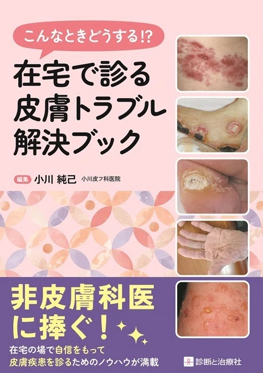 【裁断済】診療所で診る子どもの皮膚疾患 第2版 診療所で診る子どもの皮膚疾患 第2版 | 中村健一 |本 | 通販 | Amazon