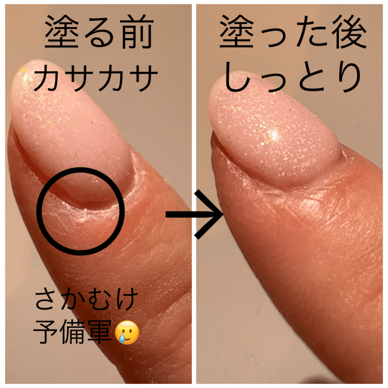 ネイル】折れがちな爪のケアを頑張ってみた｜港区OLきい