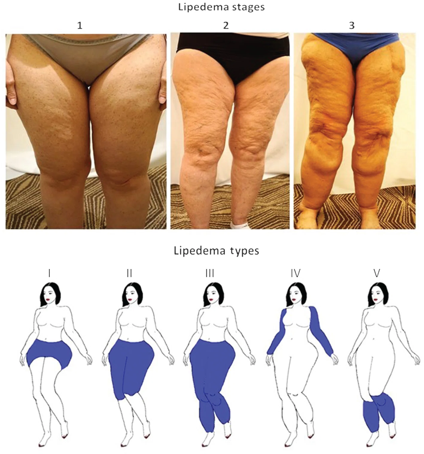 what is the average weight loss on tirzepatide per week Tirzepatide | Nudge Fit what is the average weight loss on tirzepatide per week Tirzepatide | Nudge Fit