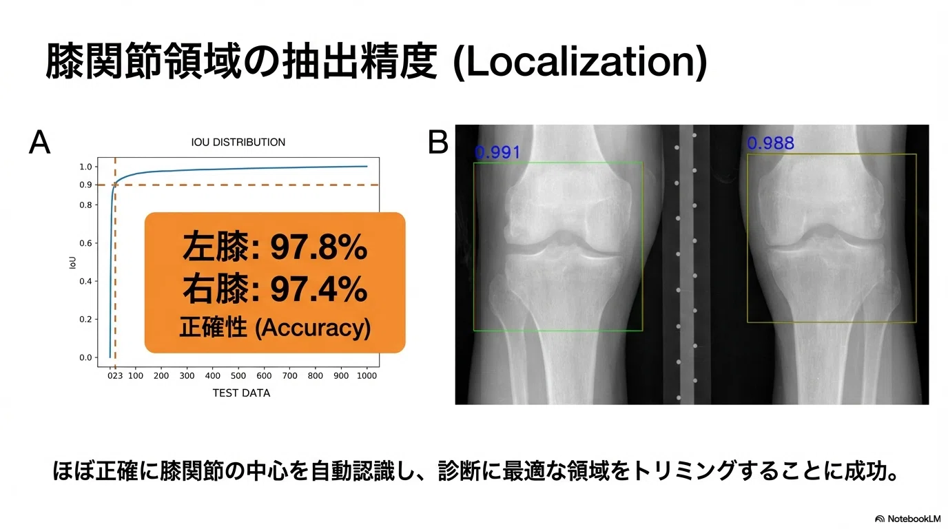 2026最新 AI×医療】 AIがレントゲン画像を瞬時に読み解く！ 変形性膝
