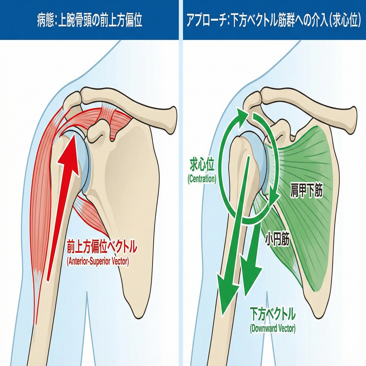 可動域は改善したのに、最後の痛みが取れない…」と悩む若手へ。肩関節