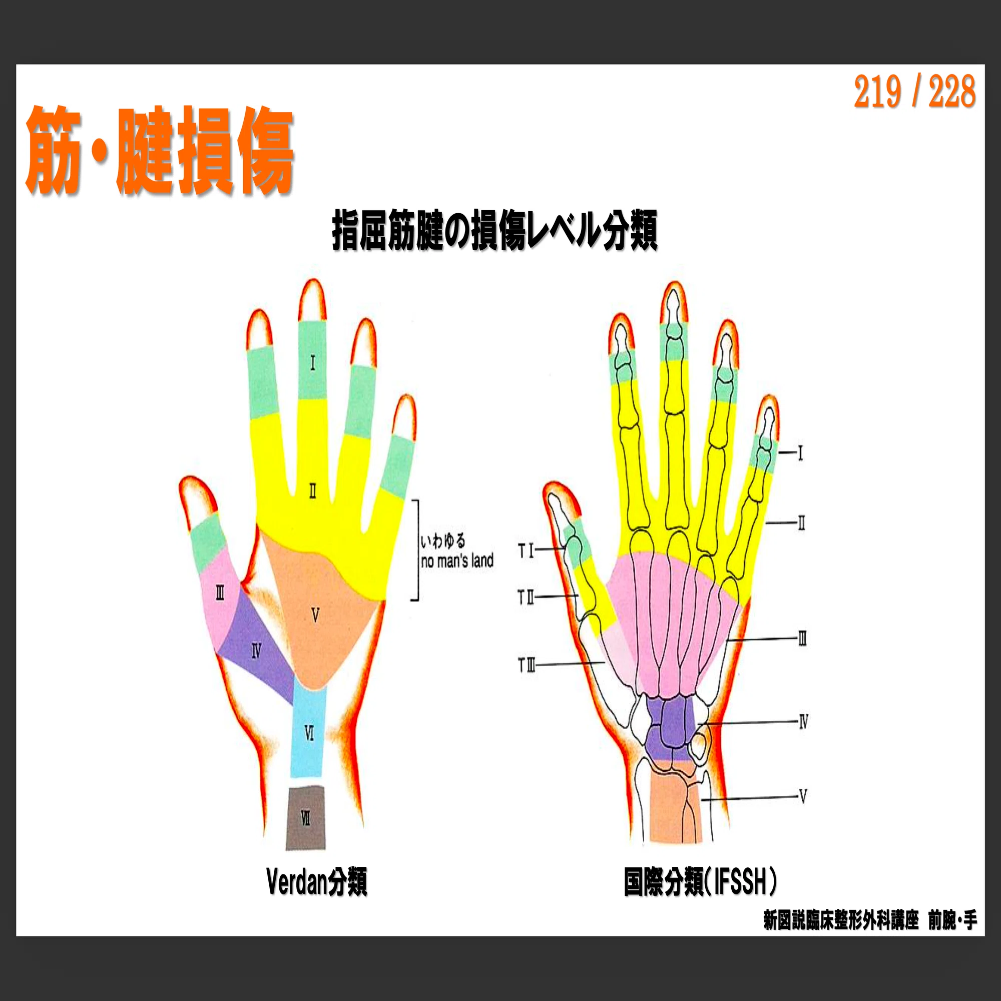 有料動画】手関節の解剖/生理/運動学｜Conditioning Room-S