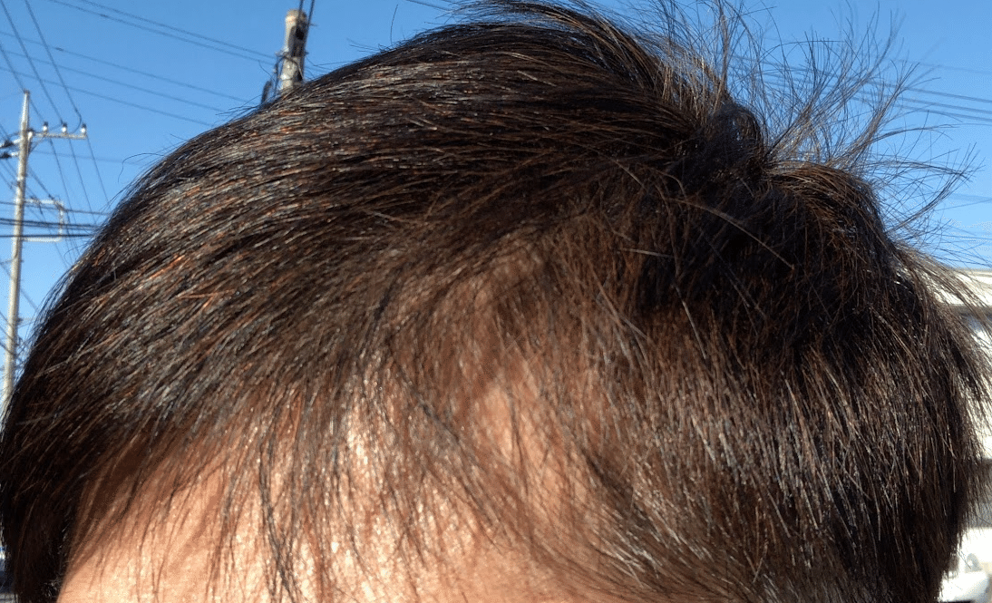 俺のエピソード noteベース 83 画像