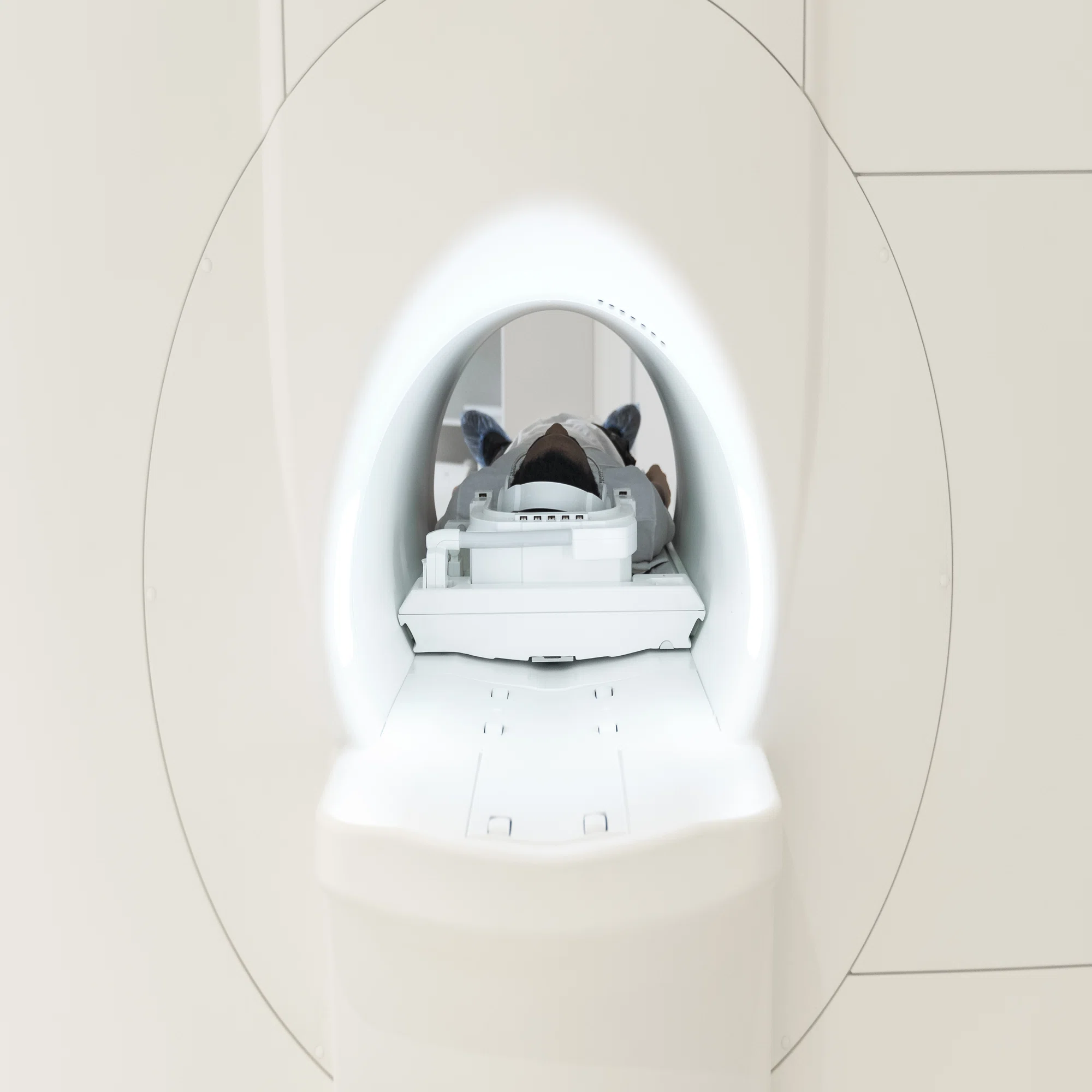 mri 検査 怖い
