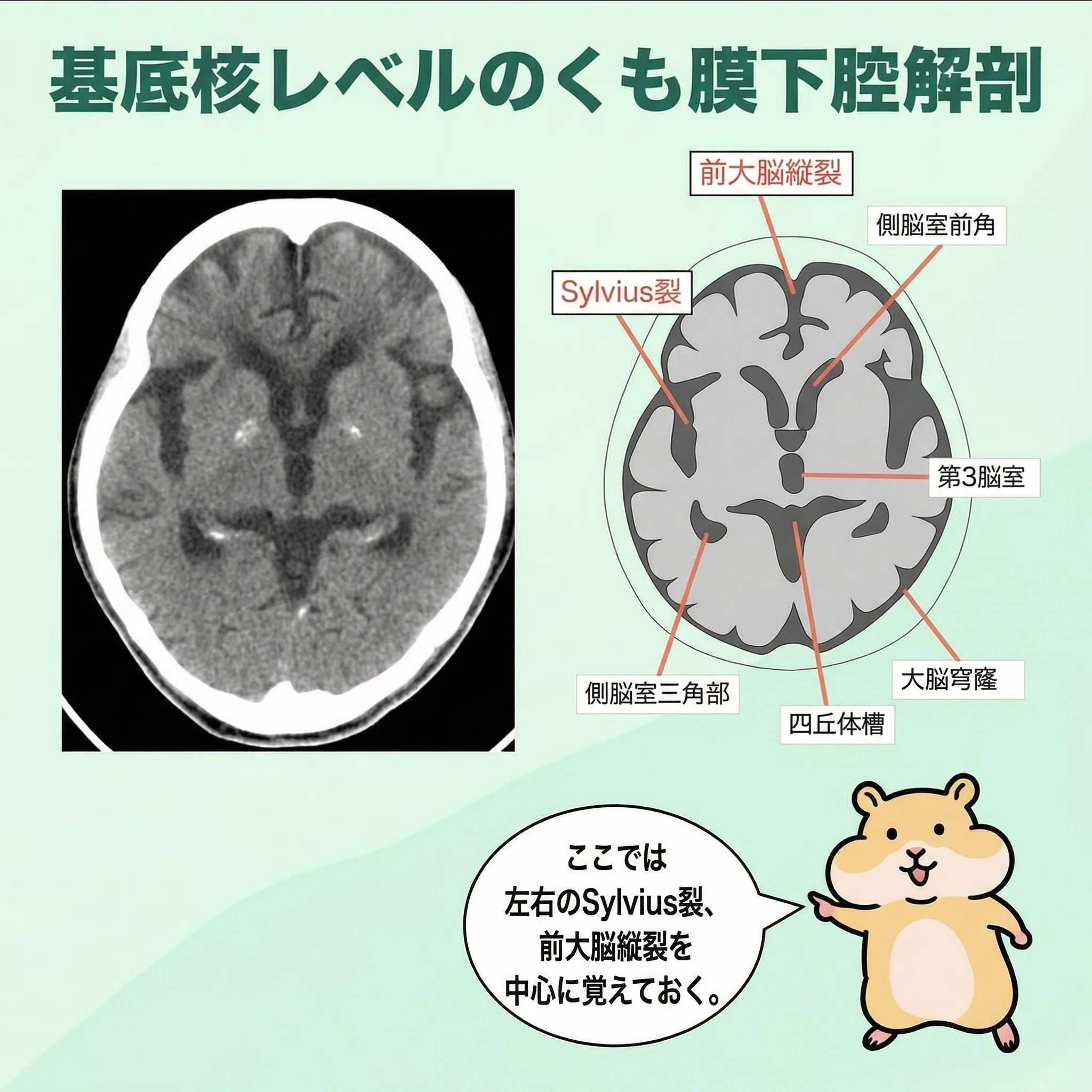 頭部CTやMRIで知って起きたい「くも膜下出血」を見逃さないための