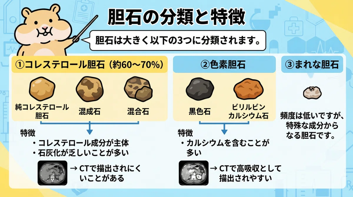 胆石の種類とCT検査の注意点!「見えない胆石」にどう向き合うか?|とっとこ画像診断太郎
