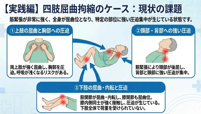 とりあえず先輩の真似」から卒業！1〜5年目PT・OTのための、根拠が