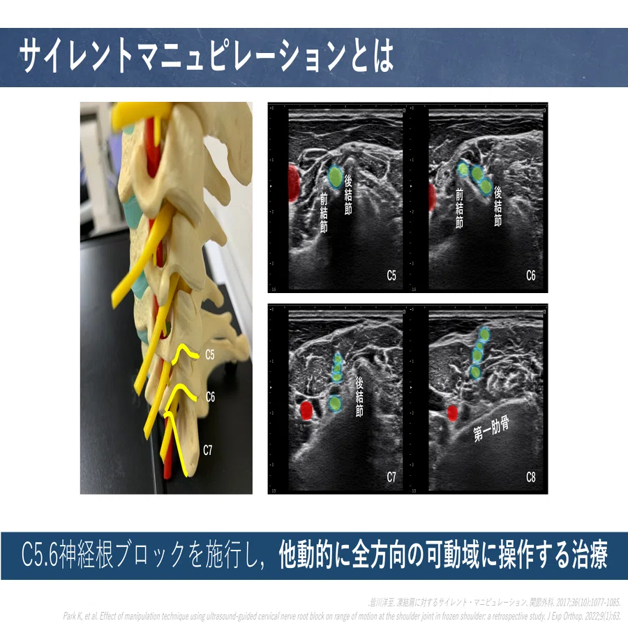 定期購読版】授動術後の肩関節（構造）｜肩関節機能研究会 郷間