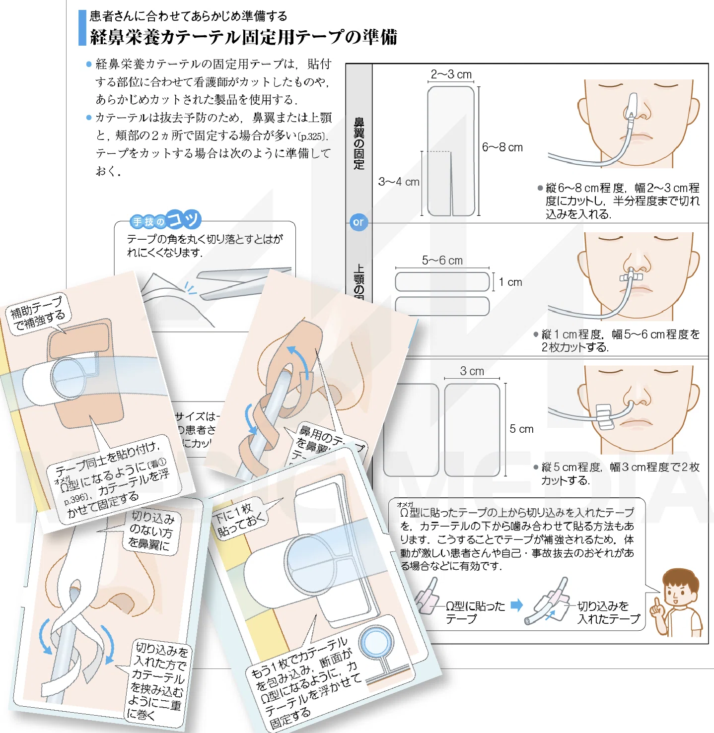 看護がみえるvol.2 臨床看護技術』（第2版）発行のお話｜MIG 