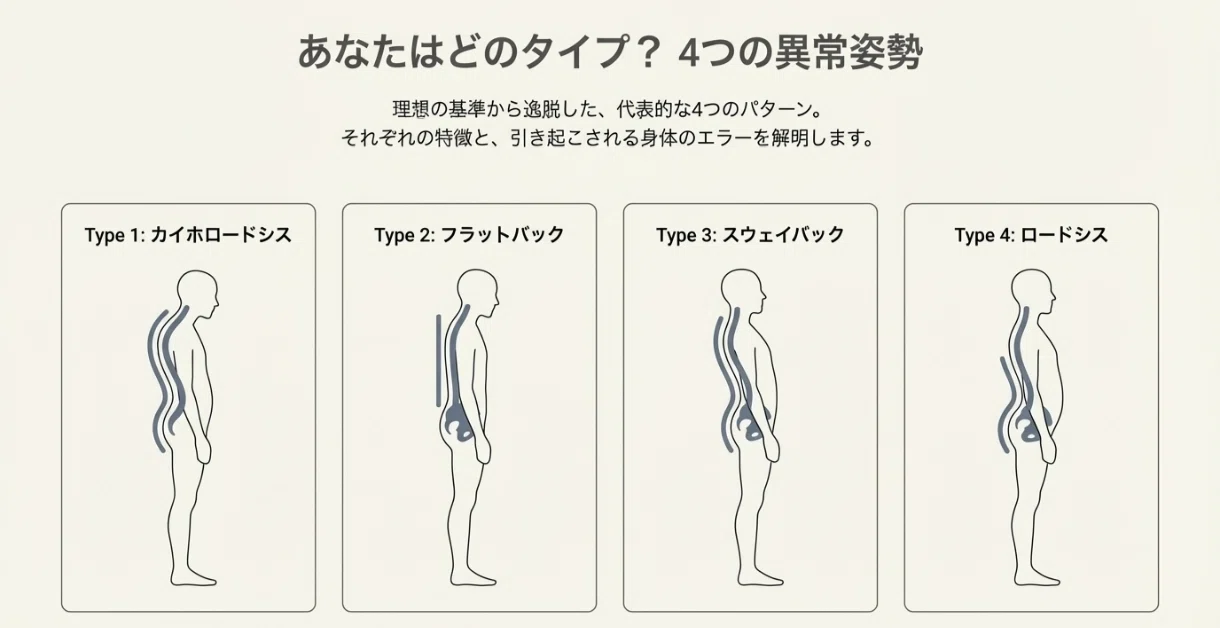 異常姿勢シリーズ0】姿勢の常識を覆す！ケンダル式でわかる理想と不調