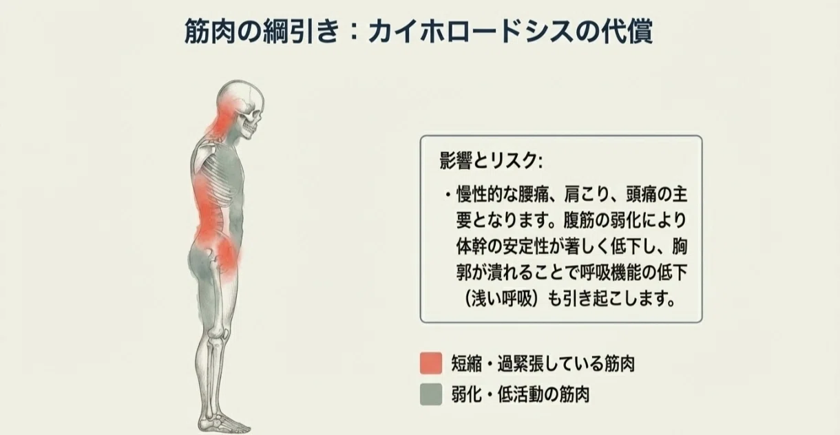 異常姿勢シリーズ0】姿勢の常識を覆す！ケンダル式でわかる理想と不調