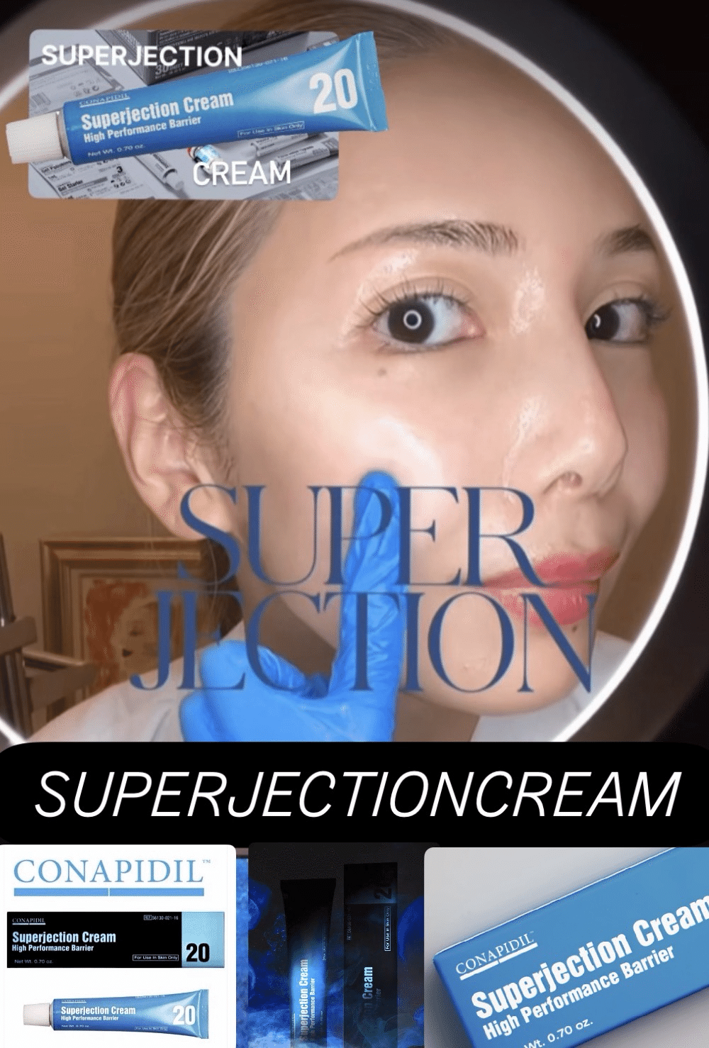 SuperjectionCream スーパージェクションクリーム　シミ改善 Superjection Cream】ス－パージェクションクリームとは