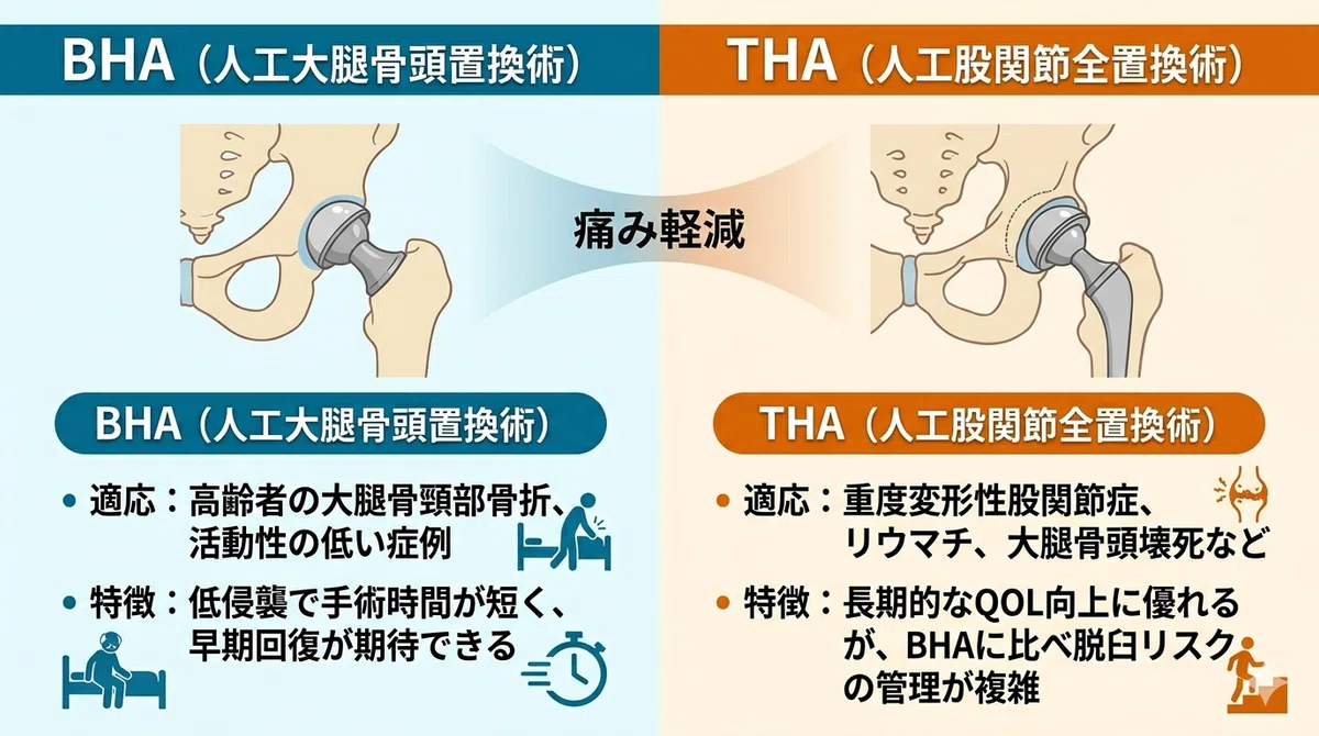 BHA・THA術後リハビリテーション完全ガイド｜アプローチ別脱臼防止と