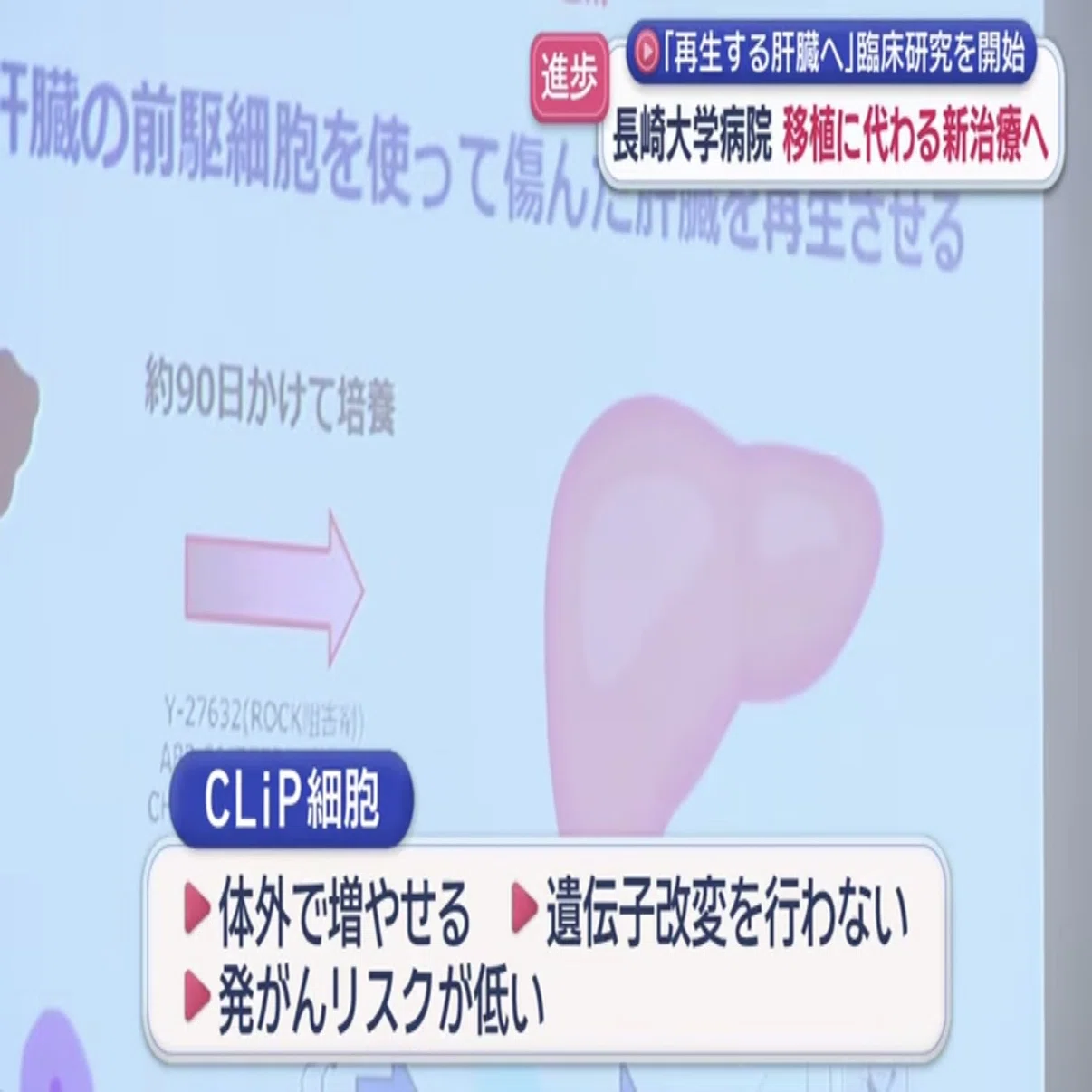 肝移植に代わる新たな選択肢に?「肝細胞を若返らせる」肝臓再生治療で