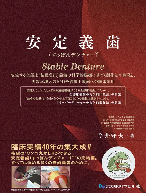 Imai Method Complete Denture リンゴ丸かじりができる Imai Method Complete Denture リンゴ丸かじりができる 【公式通販】