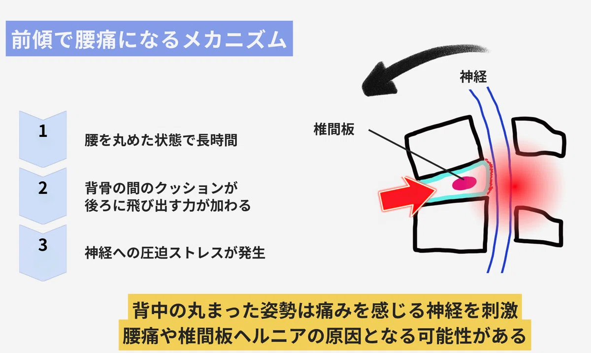 前傾作業の腰部負担は1.5倍!製造業現場で使える対策のポイント|株式会社フィジコム・ラボ