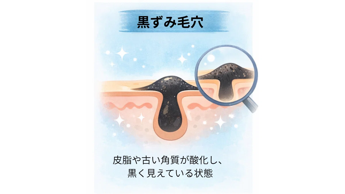 毛穴シリーズ⑥】あなたの毛穴、どのタイプ？原因別ケアの考え方