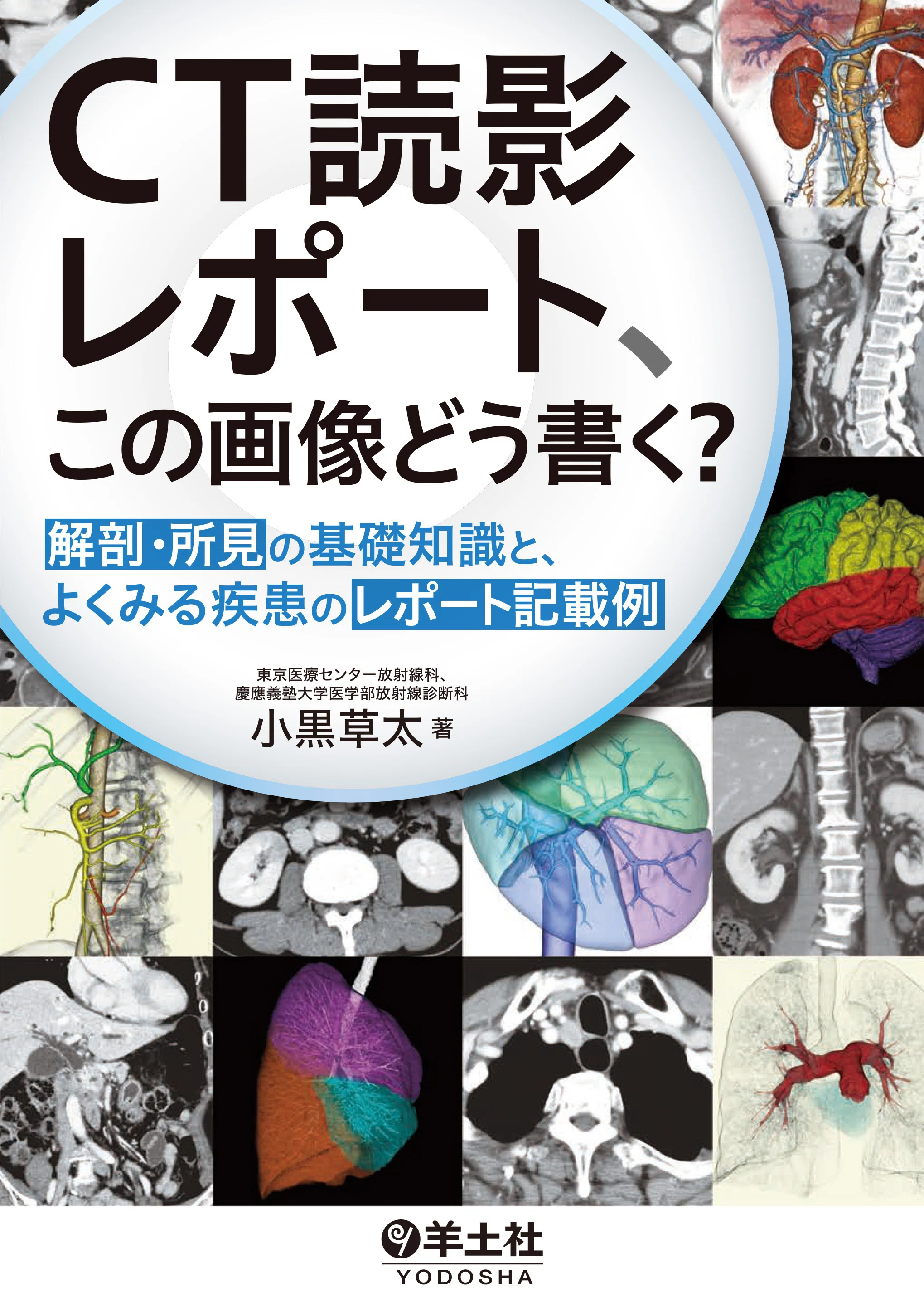注目の10点をご紹介！『画像診断』特集 【2026年版】｜医書.jp/医学