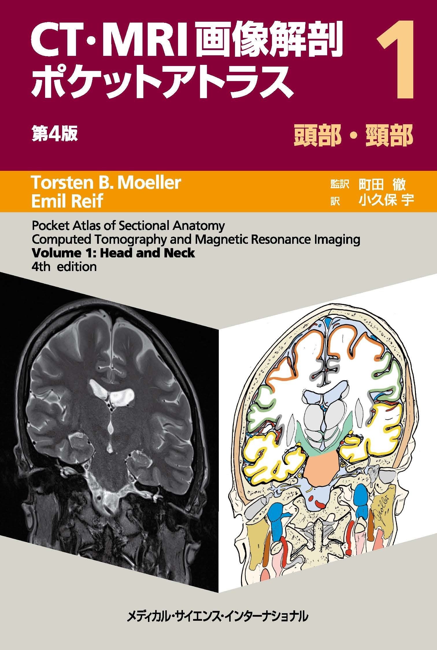 注目の10点をご紹介！『画像診断』特集 【2026年版】｜医書.jp/医学