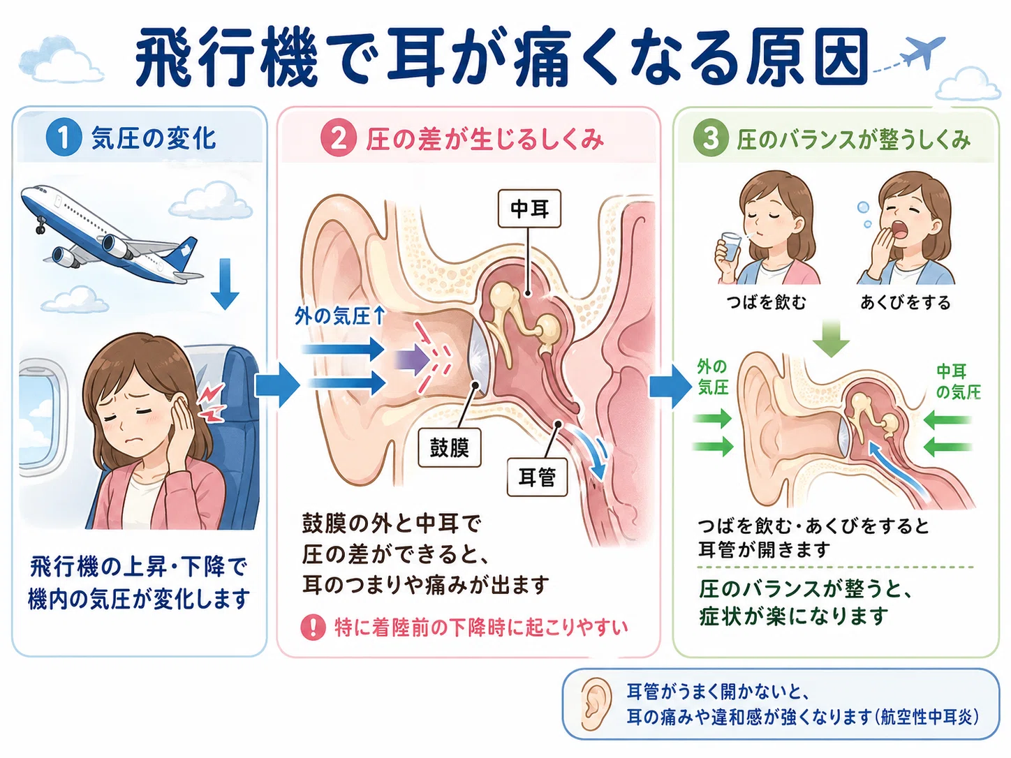 飛行機 耳 痛い