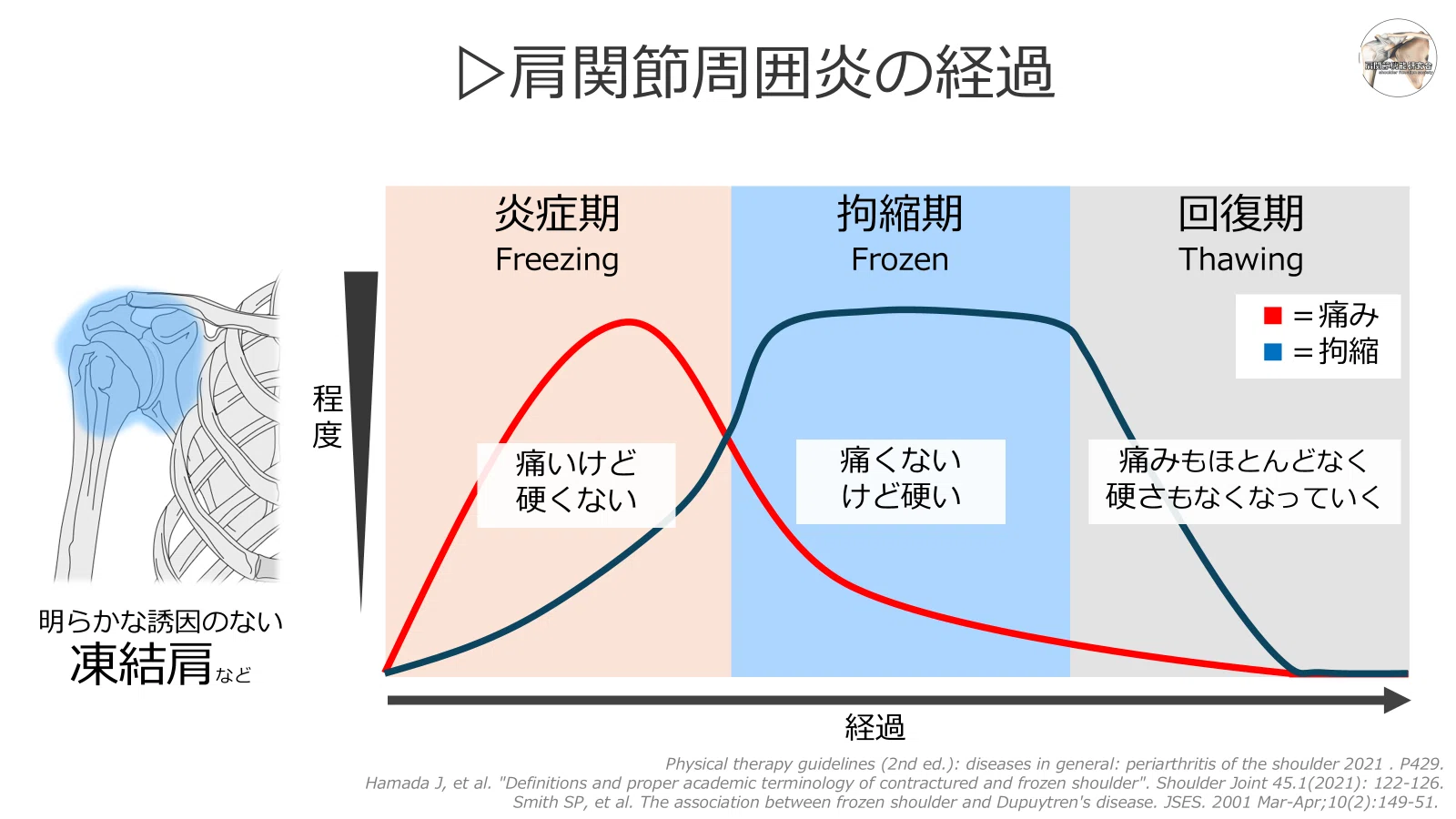 定期購読版】エビデンスに基づくストレッチ｜肩関節機能研究会 郷間