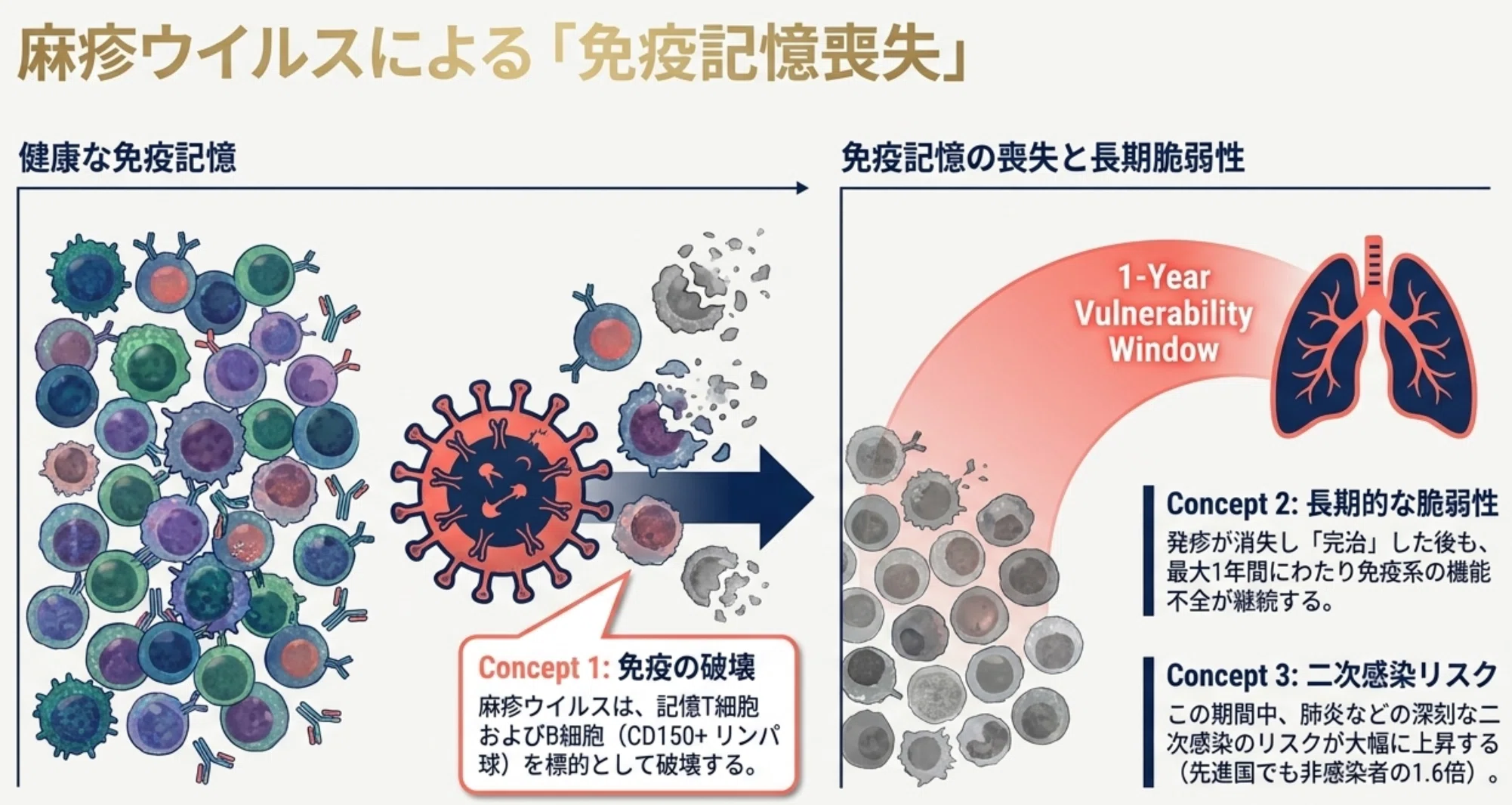 麻疹 免疫 リセット