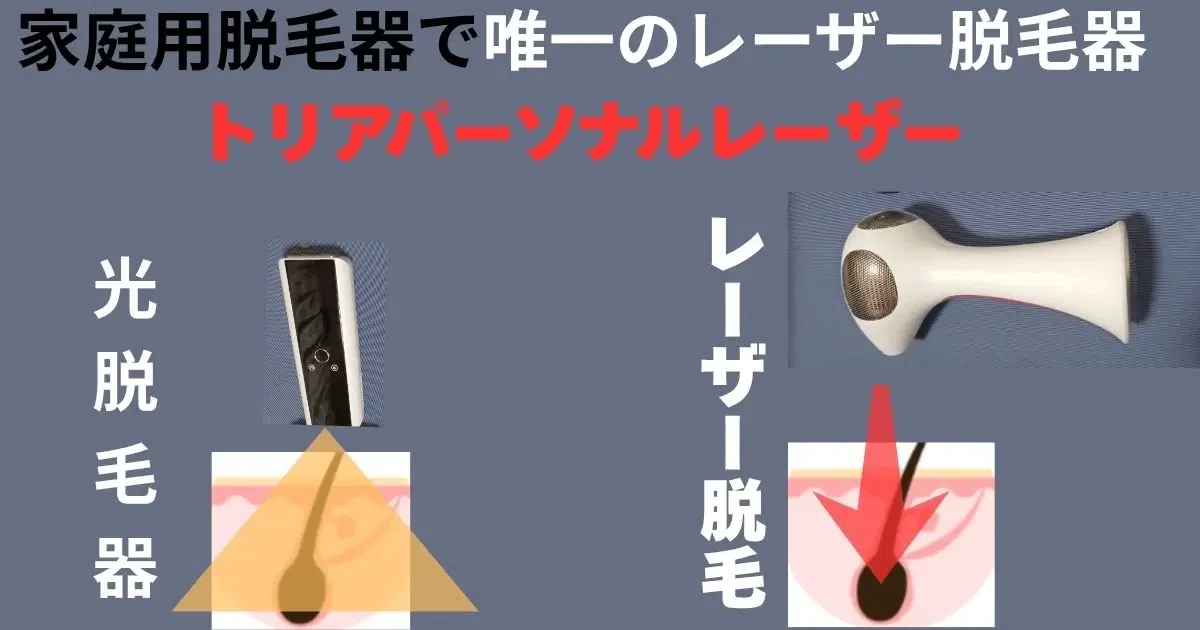 ひげ脱毛」30時間リサーチした結果、トリア4Xを選んだ理由と、実際に ひげ脱毛」30時間リサーチした結果、トリア4Xを選んだ理由と、実際に