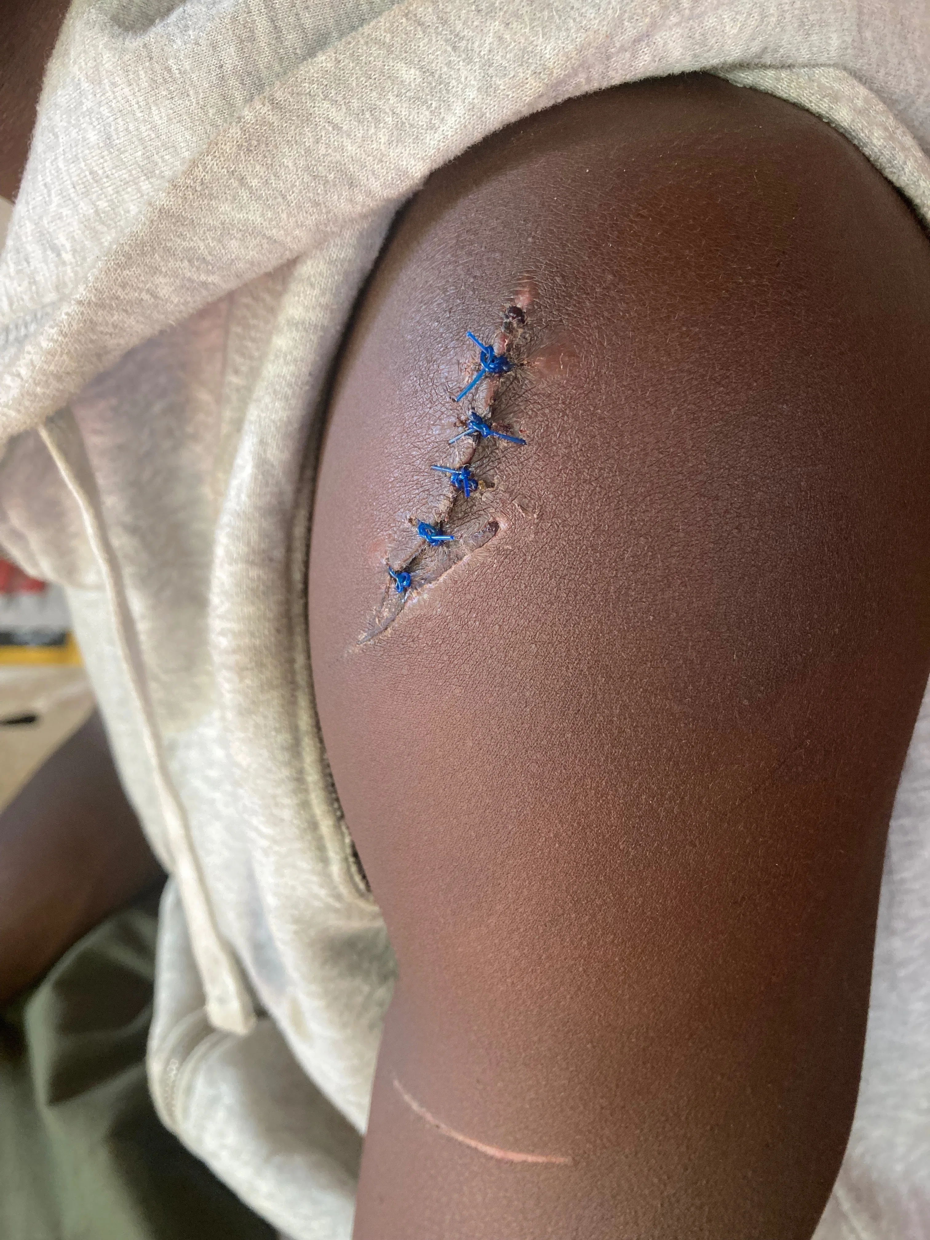 マサイ族の彼のこと☺︎ PART❷｜タンザニア🇹🇿青年海外協力隊【観光