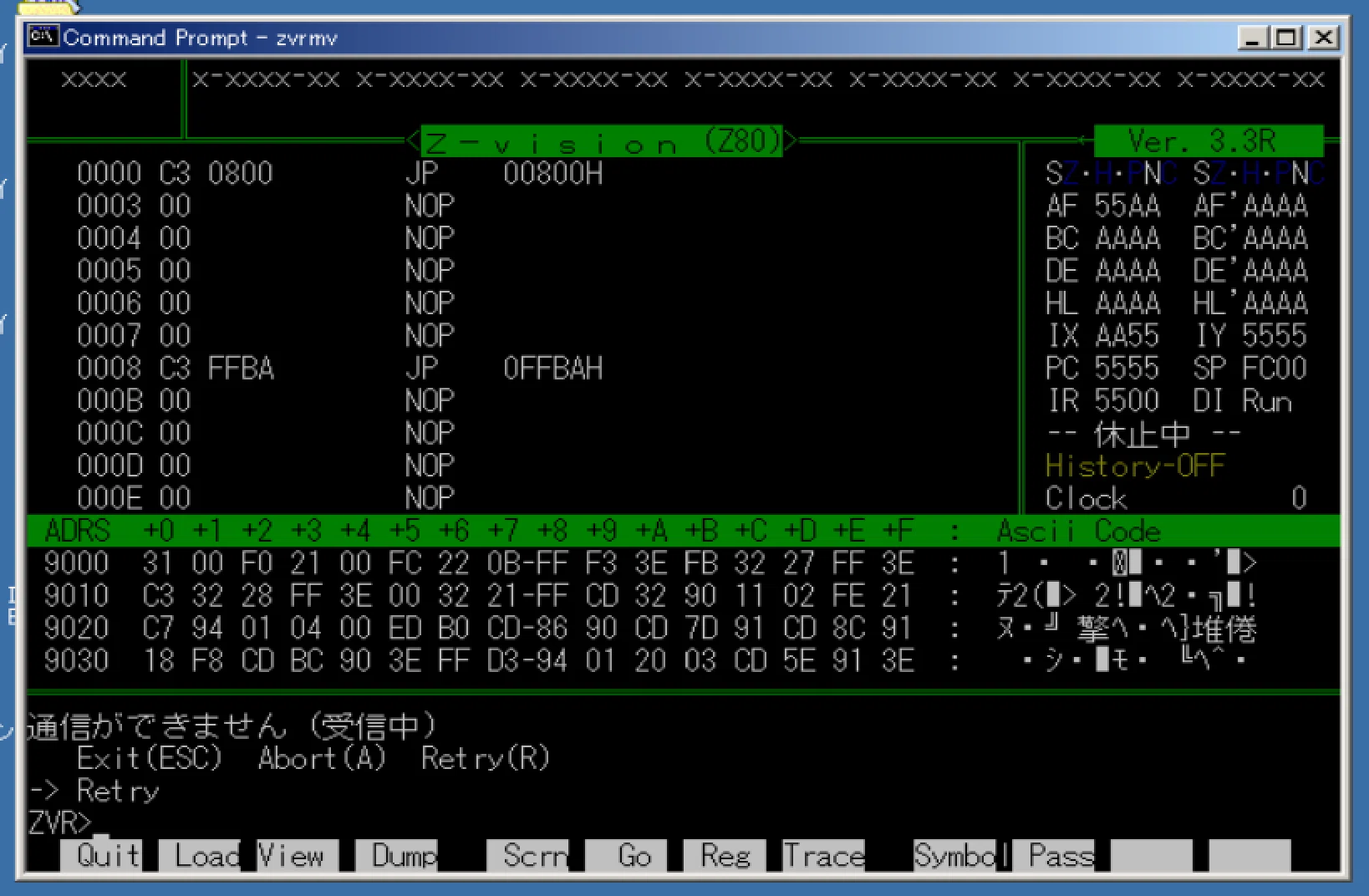 Digitallyページ ND80Z3.5にZ-Vision Remoteを組み込む。｜madeli