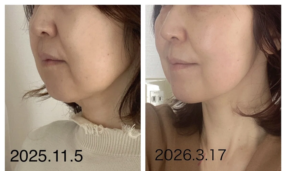 before after 美容