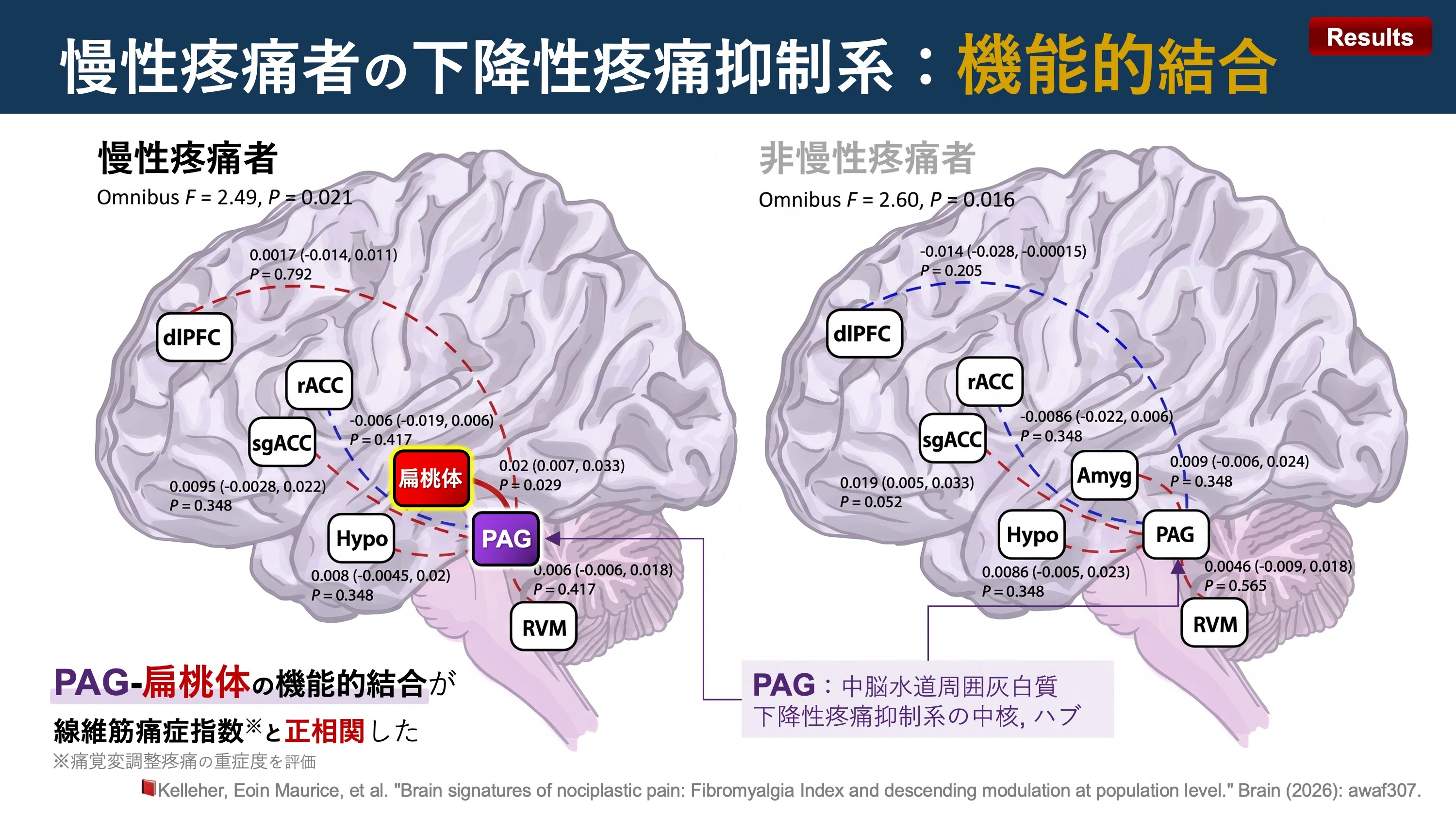 慢性疼痛者の下降性疼痛抑制系｜Super Human | 理学療法士／保健学博士