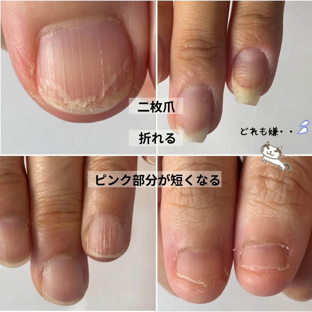 Points to Note for Summer Natural Nail Growth🌻Beware of UV Damage ️ ...