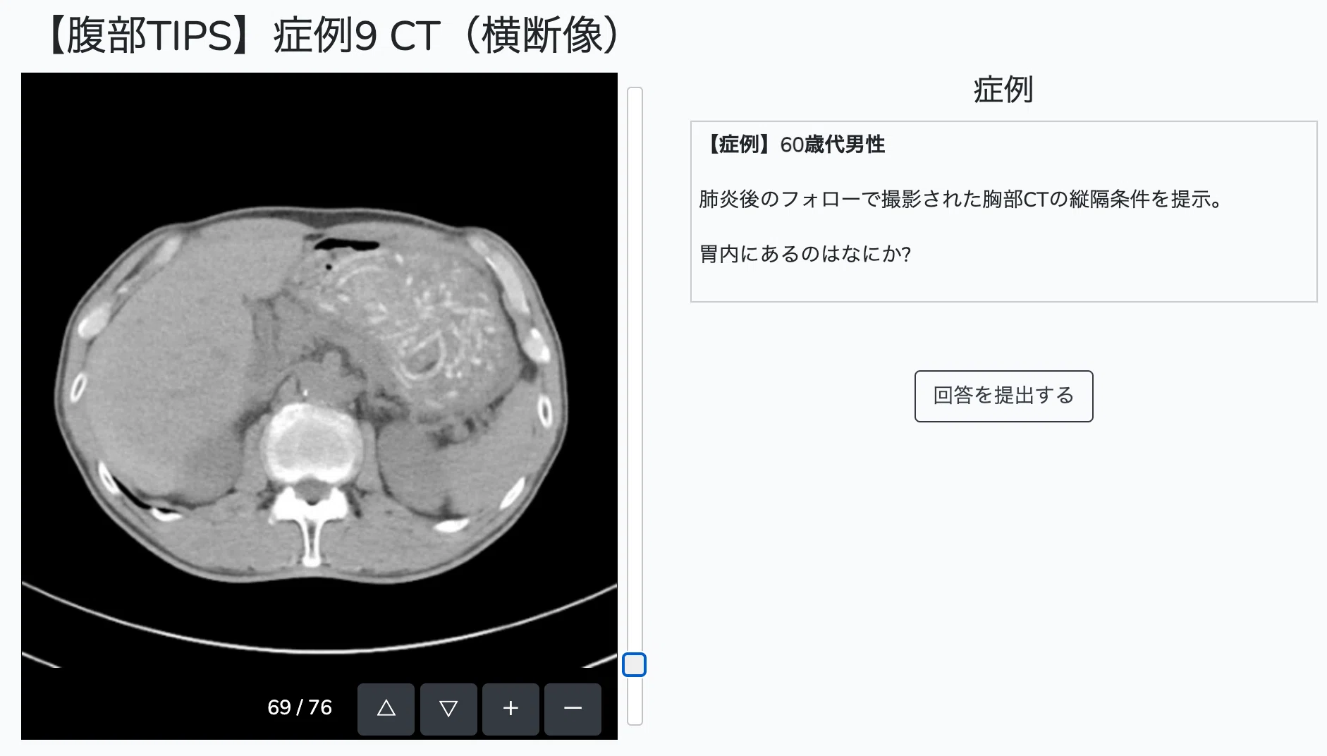 画像診断を無料で学べる4つの講座まとめ｜とっとこ画像診断太郎