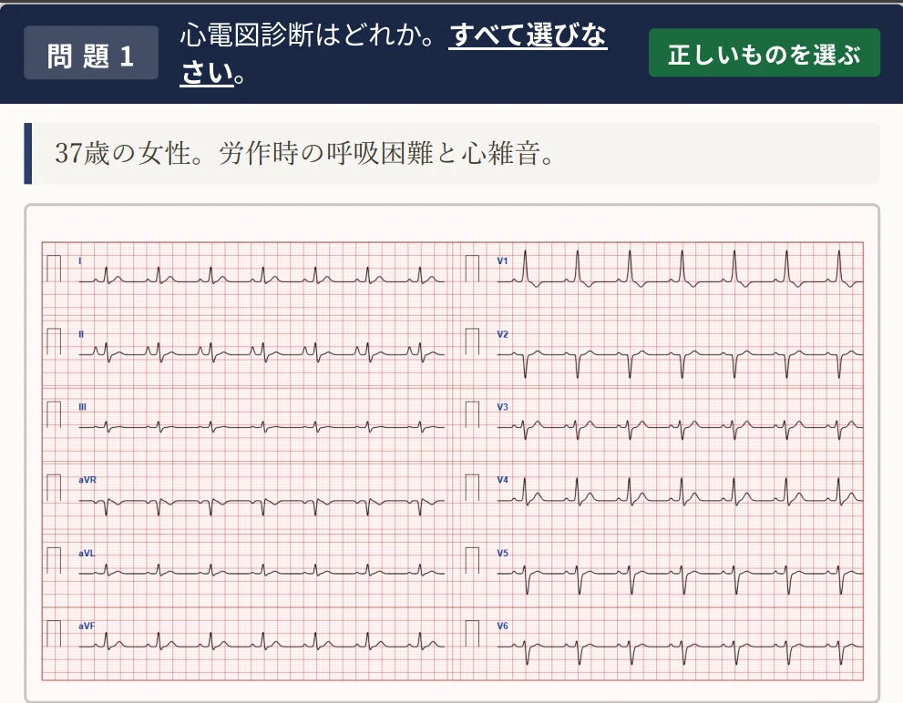 心電図検定2級の難易度と合格ラインは？「落ちた」を防ぐ過去問レベル