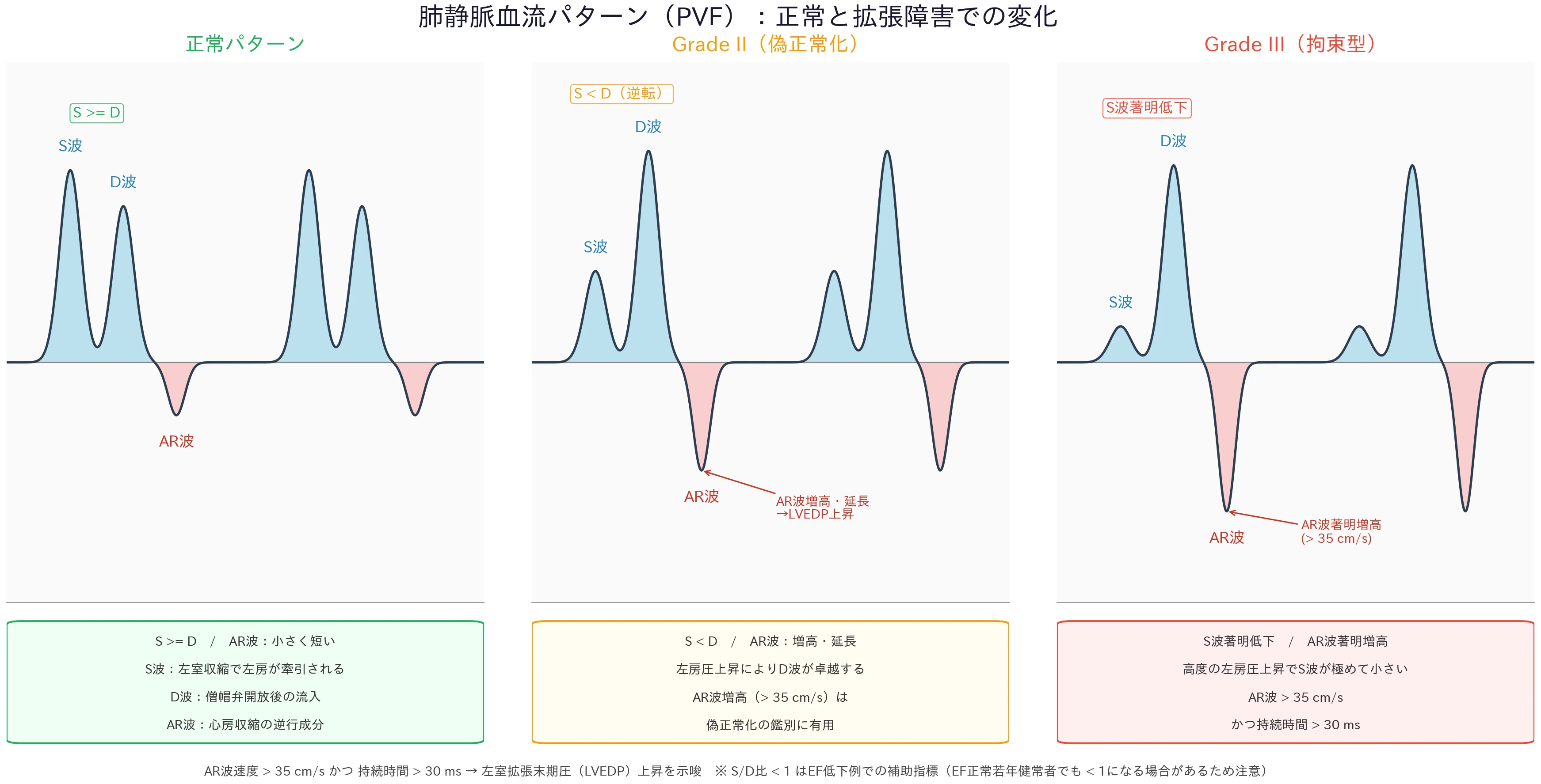 今さら聞けない心エコー：拡張機能評価の仕組みと臨床的な意味｜ハル