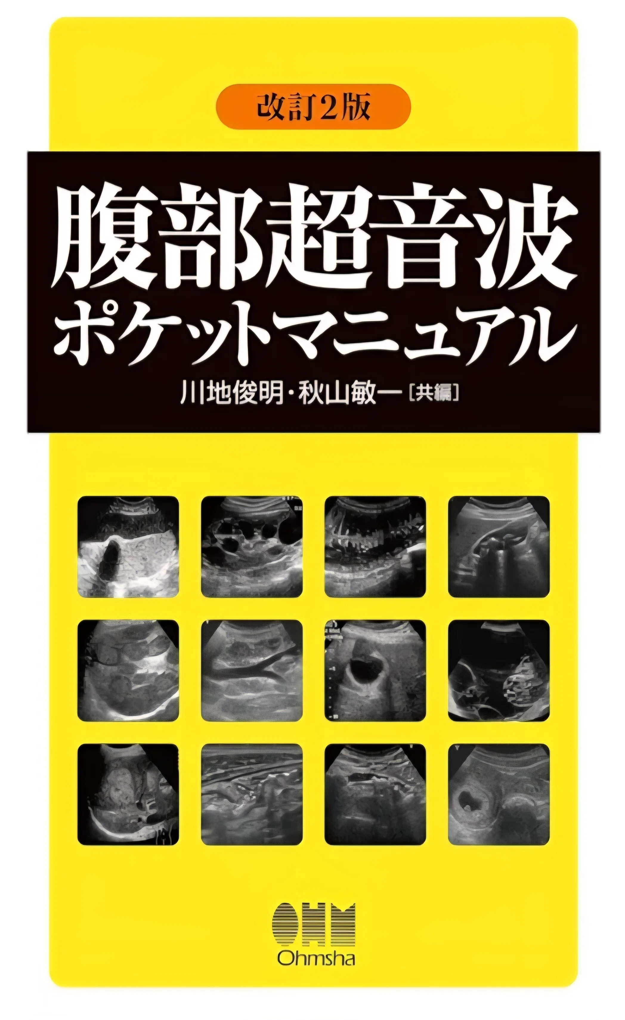超音波検査おすすめ参考書まとめ｜腹部エコー編｜もんた｜フリーランス