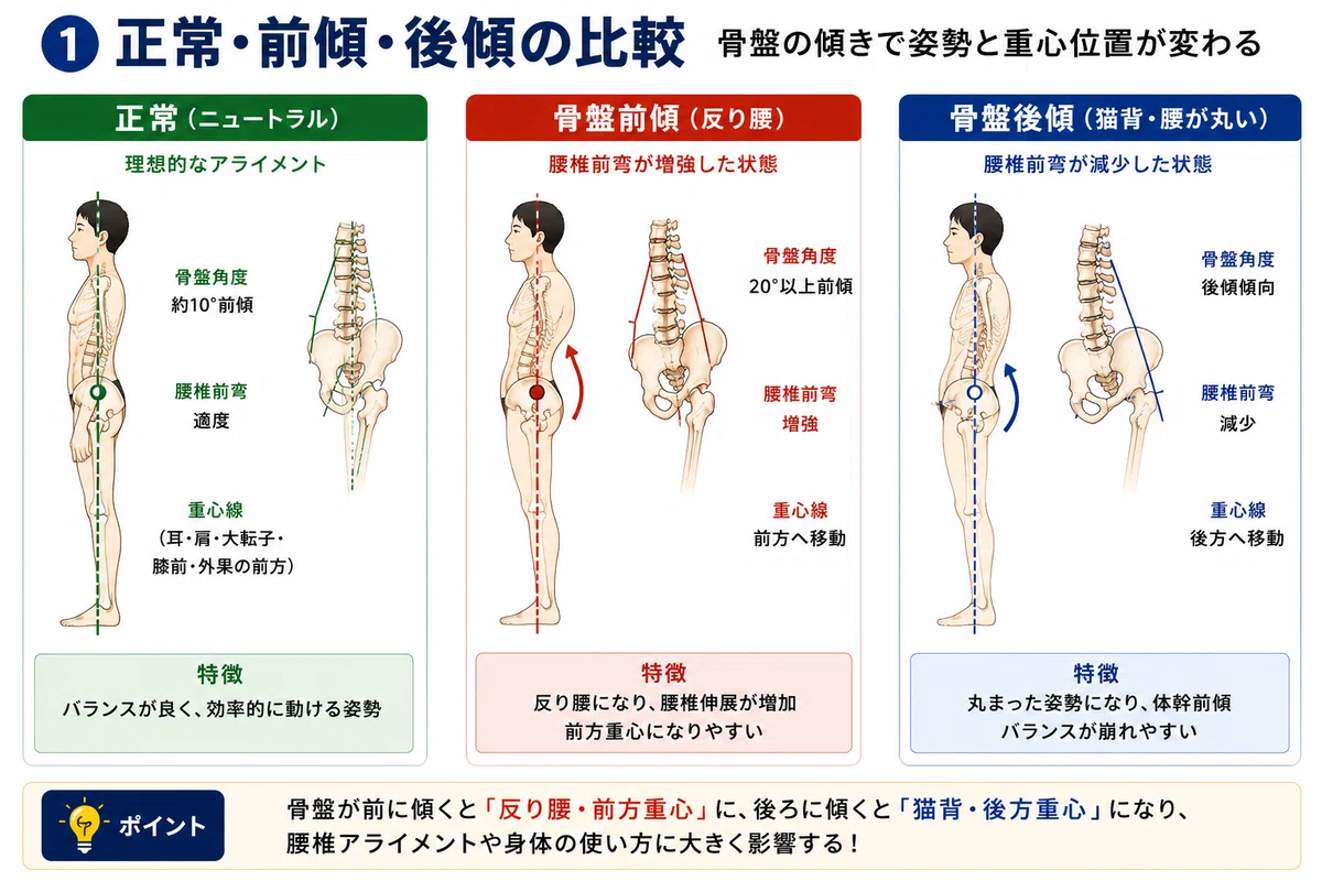 骨盤前傾・後傾で身体はどう変わる?|姿勢・筋活動・歩行をPT視点で徹底解説|マサリハ@リアル臨床・みんなのお悩み解決