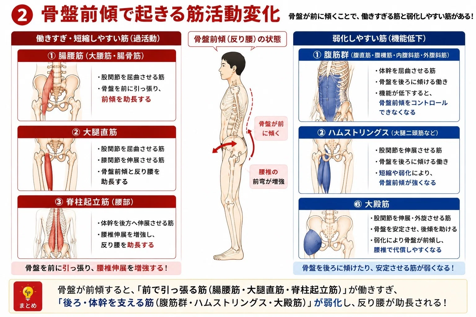 骨盤前傾・後傾で身体はどう変わる？｜姿勢・筋活動・歩行をPT視点で