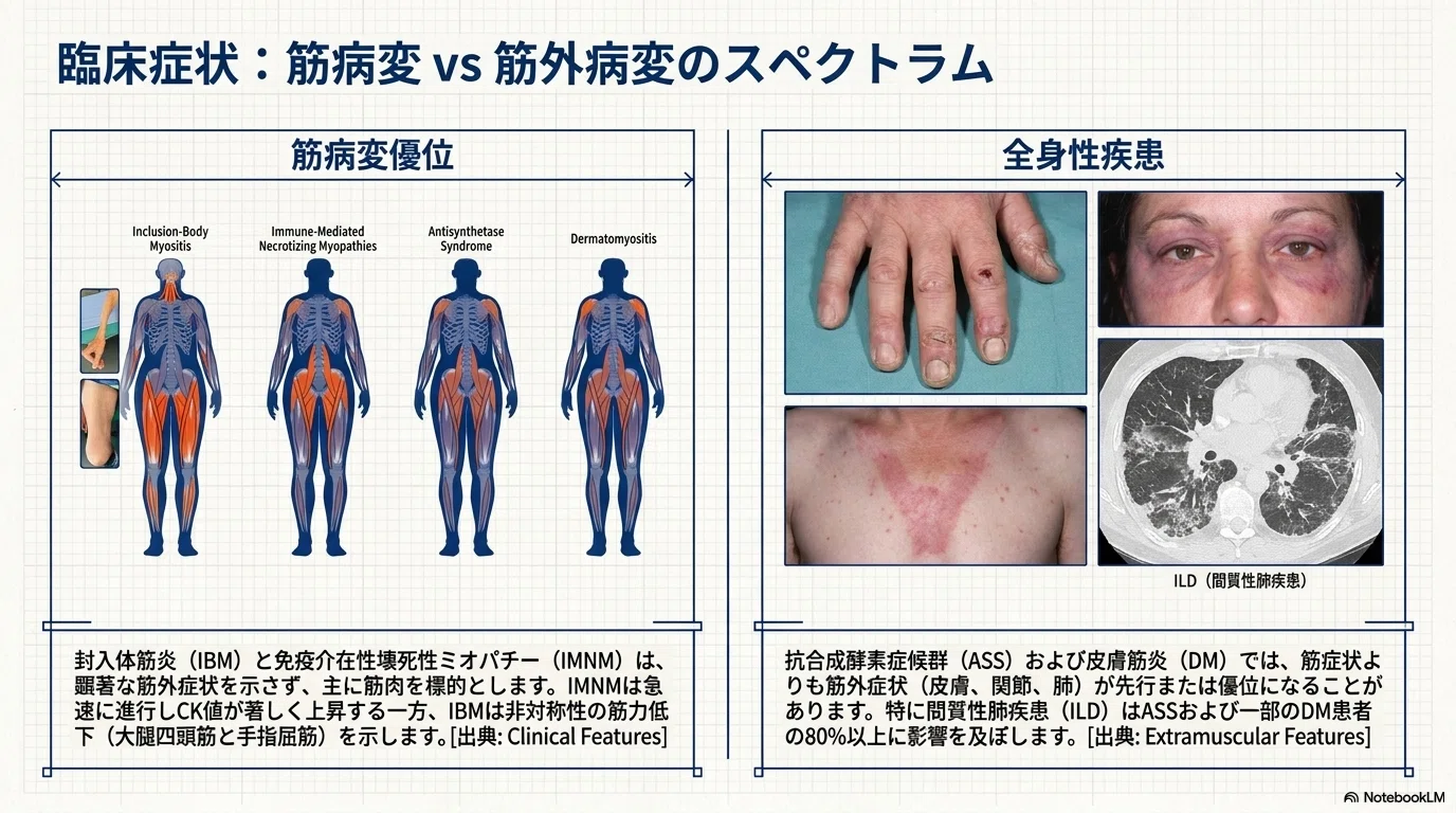 炎症性ミオパチー：4つの主要病型｜Makisey