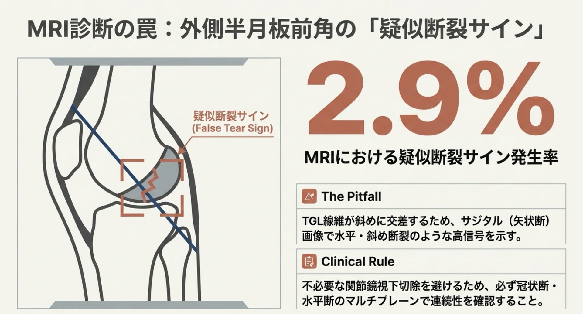 膝横靱帯｜膝神 【臨床勉強部屋】