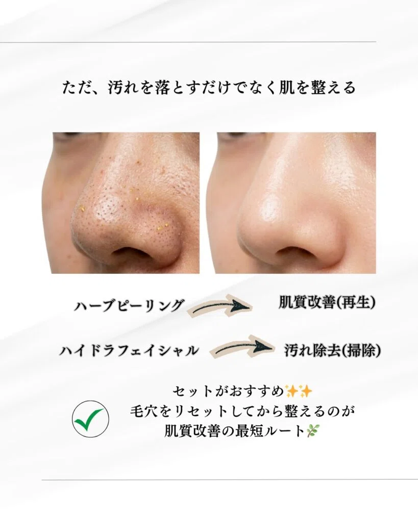 名護市で毛穴洗浄】いちご鼻・黒ずみ卒業！ハイドラフェイシャルが「肌