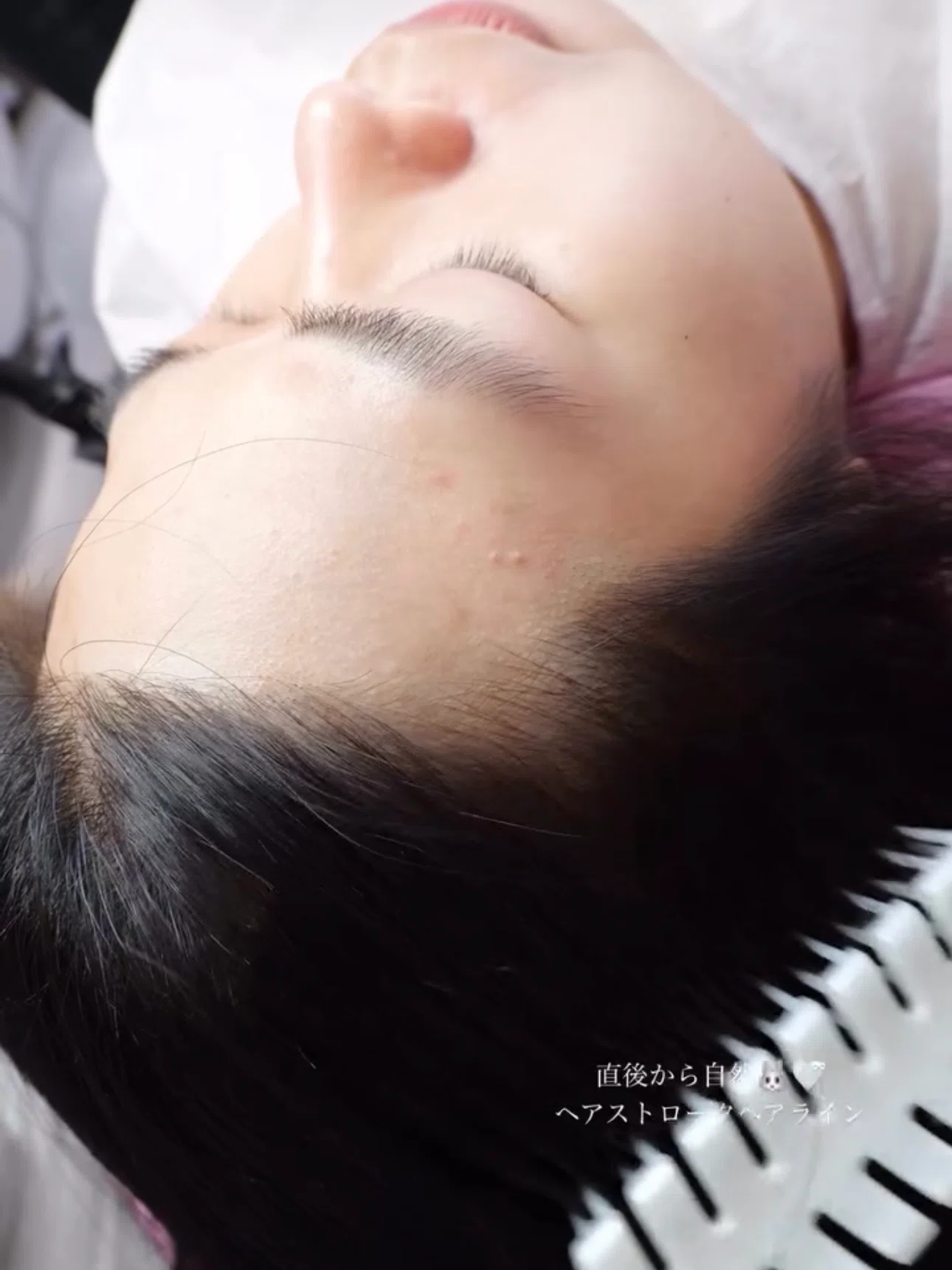 🔸ヘアラインアートメイク  / 2回132,000円〜｜仙台アートメイク