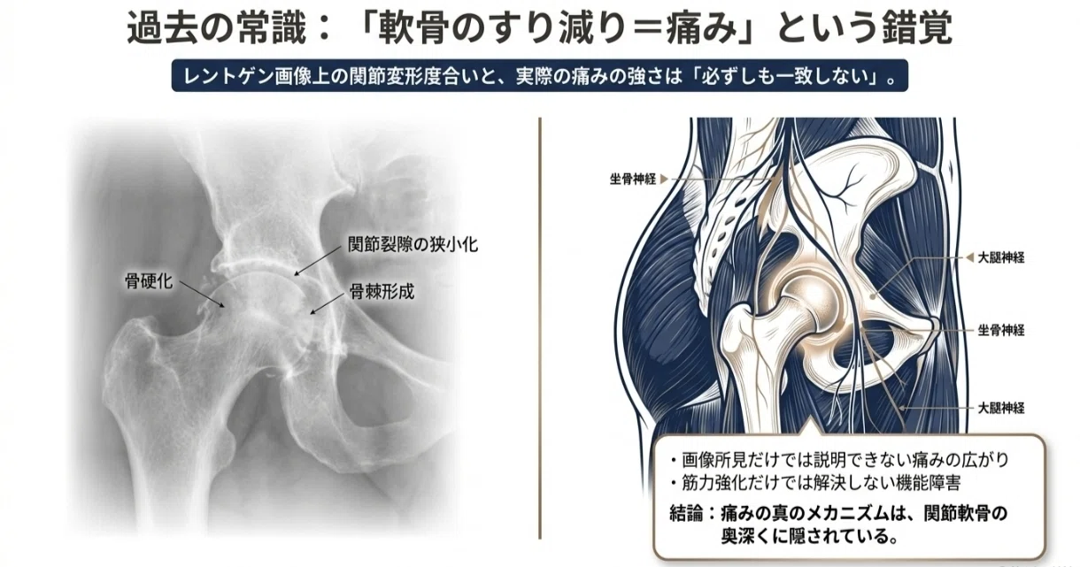 図説股関節の臨床 変形性股関節症:最新ガイドライン徹底解説｜Kenji Miyamoto | 認定理学