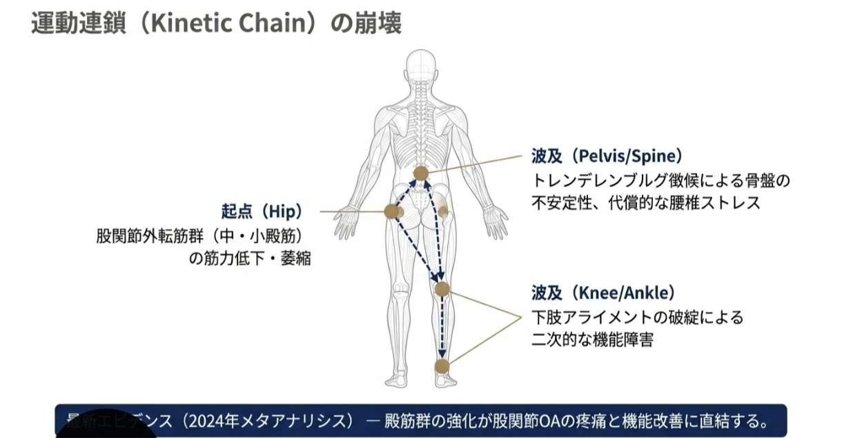 変形性股関節症:最新ガイドライン徹底解説｜Kenji Miyamoto | 認定理学