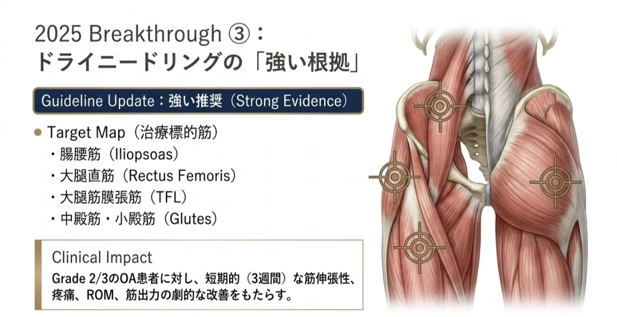 変形性股関節症:最新ガイドライン徹底解説｜Kenji Miyamoto | 認定理学