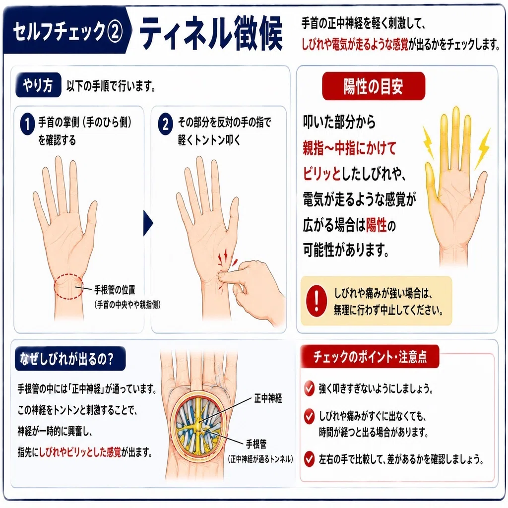 理学療法士が解説】手根管症候群セルフチェック｜その手のしびれ 